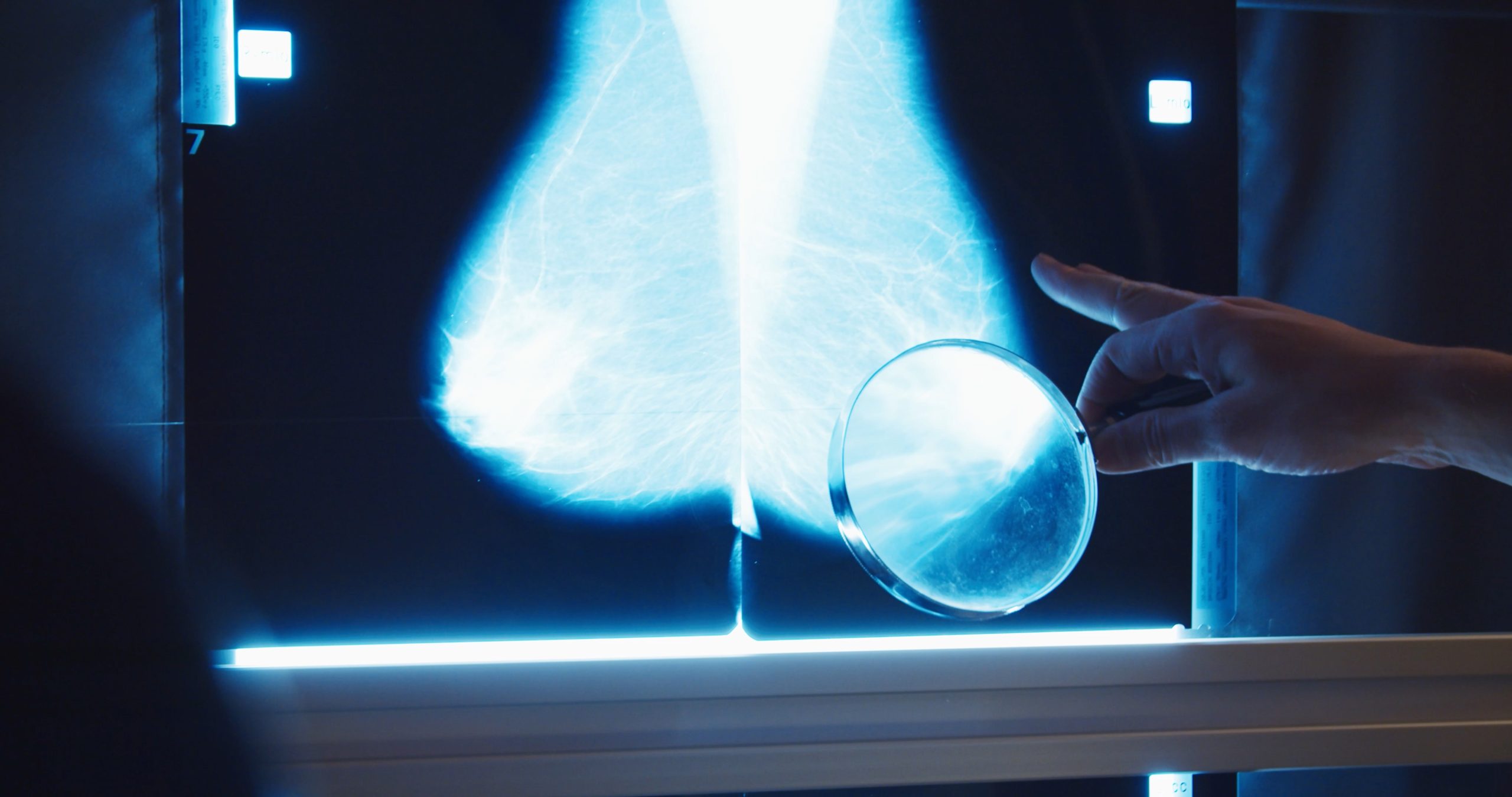 Mammogram close-up